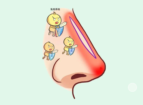 徐利刚避雷纯属谣言！不是渠道医生做鼻子技术好，2025年最新案例对比分析