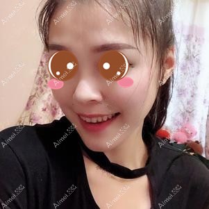 找潘宝华院长做下颌角手术2个月恢复 找潘宝华院长做下颌角手术2个月恢复