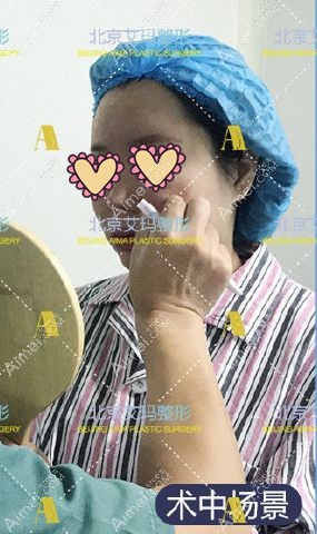 北京艾玛李方奇院长取面部生长因子术前设计.jpg