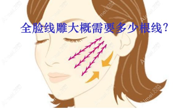 全脸埋线提升大概需要多少根线 全脸埋线提升大概需要多少根线