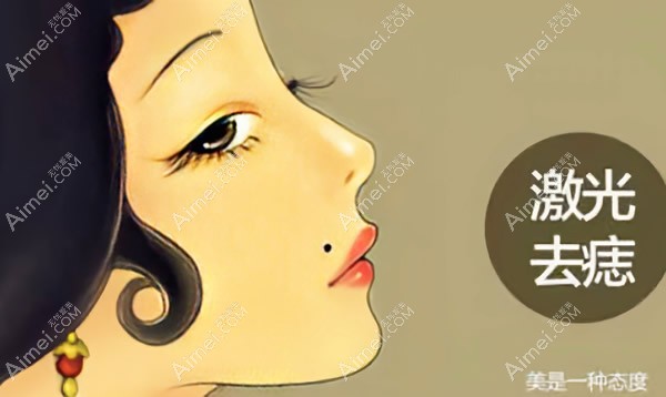 激光点痣怎么样