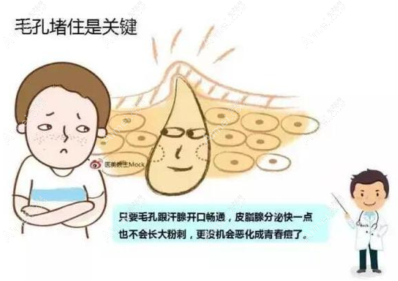 青春痘的治療方式