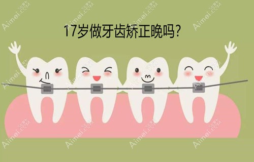 17岁做牙齿矫正晚吗?其实26、32、45岁戴牙套都不算晚