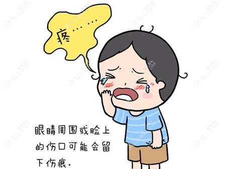 脸部拆线前不能沾水洗脸以免感染.jpg