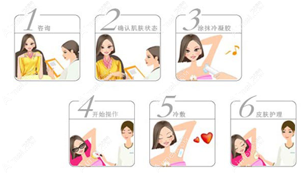冰点脱毛的正确步骤 冰点脱毛的正确步骤