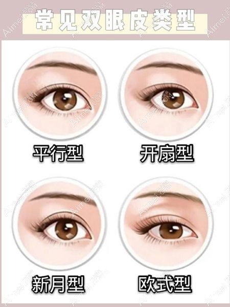 平行型双眼皮是4种双眼皮类型之一www.aimei.com.jpg