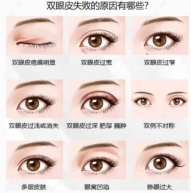 国内眼修复医生排名更新:北京/上海眼修复有名的医生均上榜