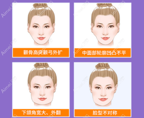广州磨骨医生排名:何锦泉,柳超和刘先超颌面磨骨排行榜前三