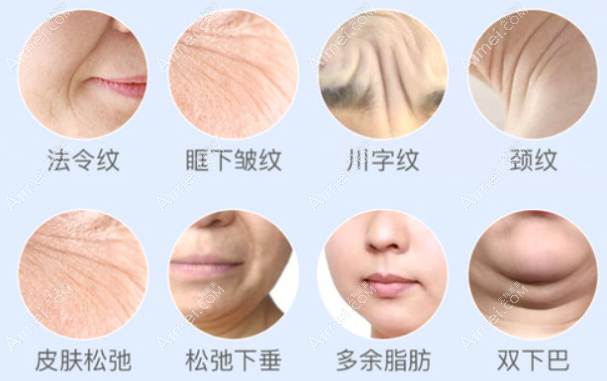 超声炮和热玛吉功效区别