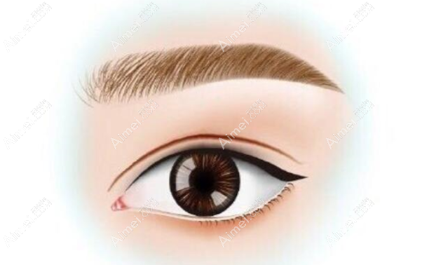 南阳天后双眼皮手术自然aimei.com