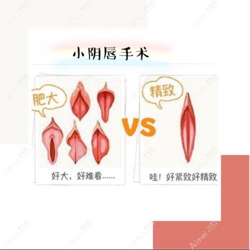 韩国女性私密整形医院排名top10分享m.aimei.com.jpg 韩国女性私密整形医院排名top10分享m.aimei.com.jpg