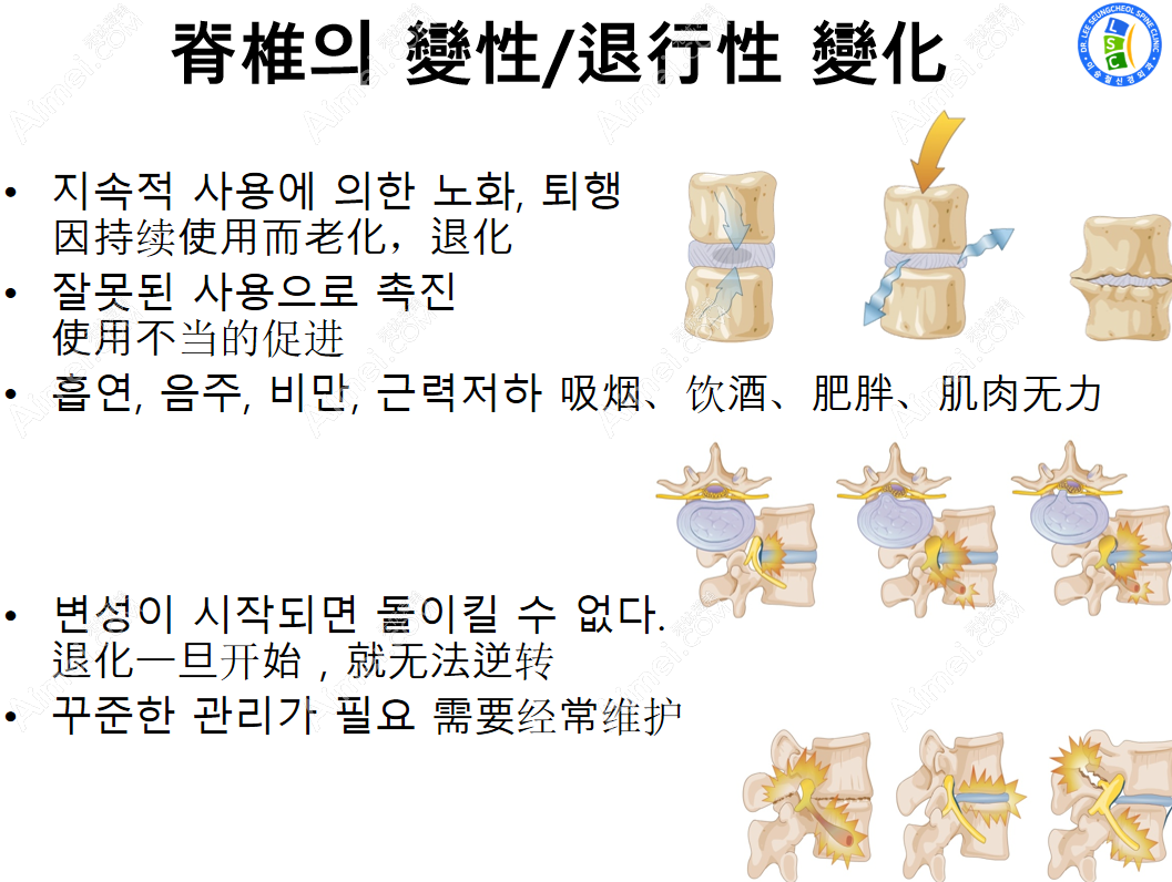 韩国李承哲神经外科腰椎病治疗价格表