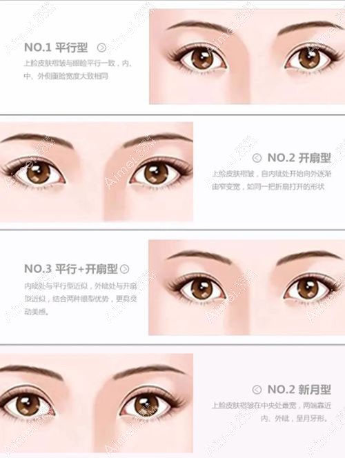 太原军大整形医院眼整形价格查询.jpg