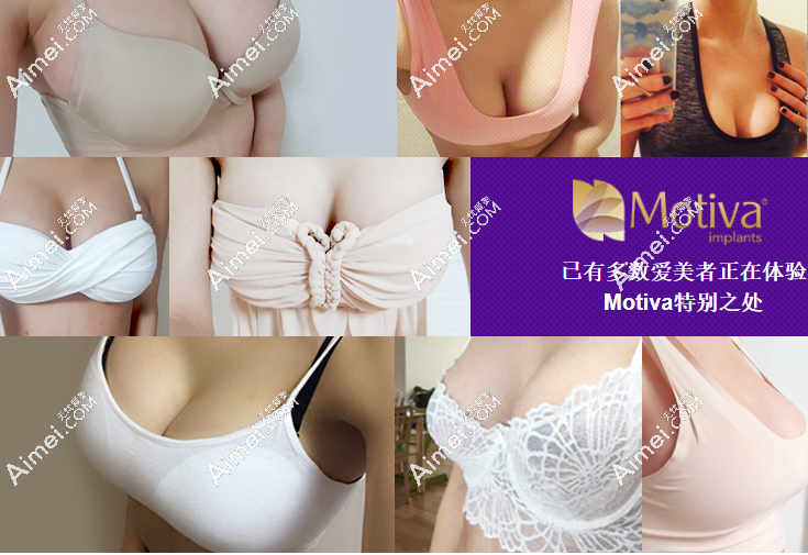 韩国假体丰胸实例多236z.com