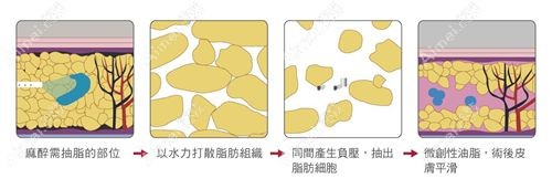 太原军大整形医院吸脂价格查询m.aimei.com.jpg