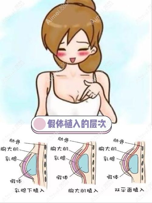 太原军大整形医院隆胸价格查询www.aimei.com.jpg