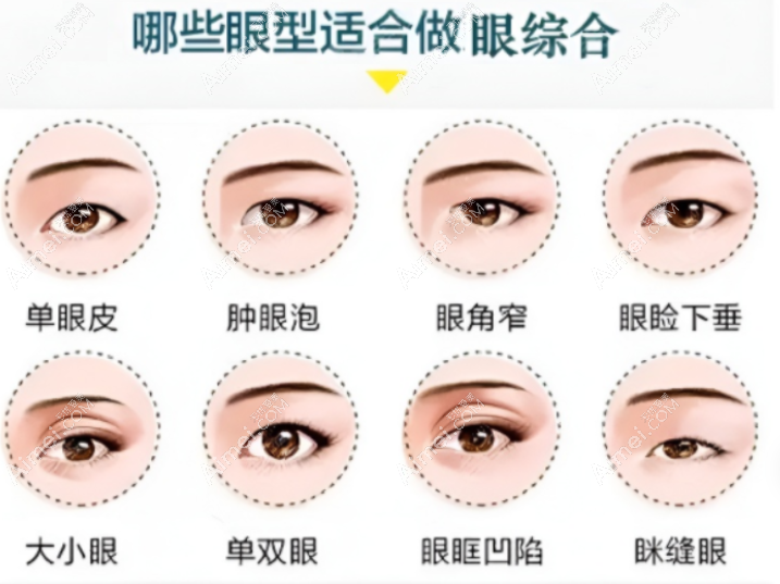 泰州施尔美双眼皮修复价格 泰州施尔美双眼皮修复价格