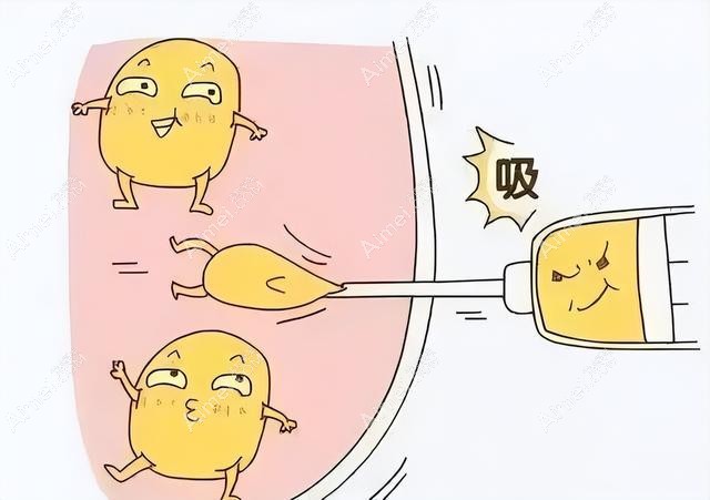 沈阳名流整形吸脂技术好aimei.com
