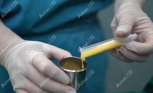 北京润美玉之光脂肪丰胸纯度高@爱美网 北京润美玉之光脂肪丰胸纯度高@爱美网