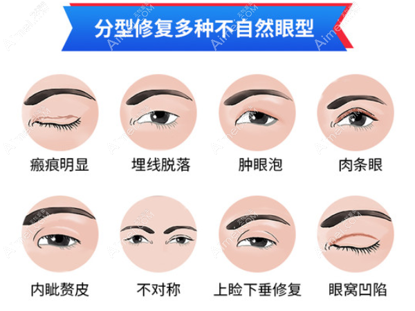 广州美莱眼修复广州排名前十 广州美莱眼修复广州排名前十