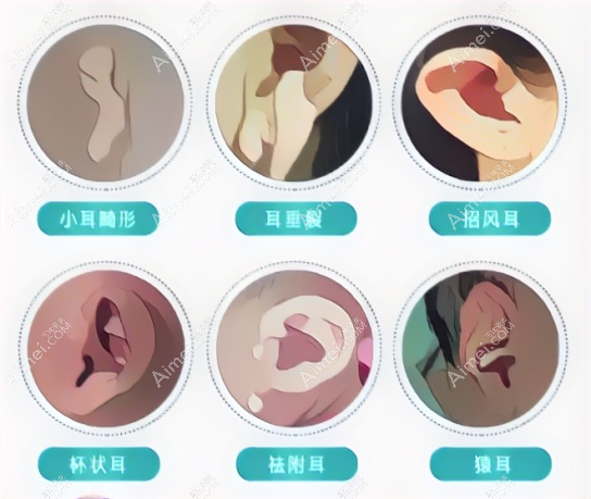 广州高尚整形是广州耳再造十大医院之一 广州高尚整形是广州耳再造十大医院之一