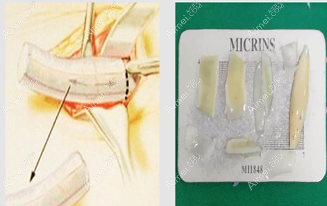 劉彥軍做鼻子靠譜