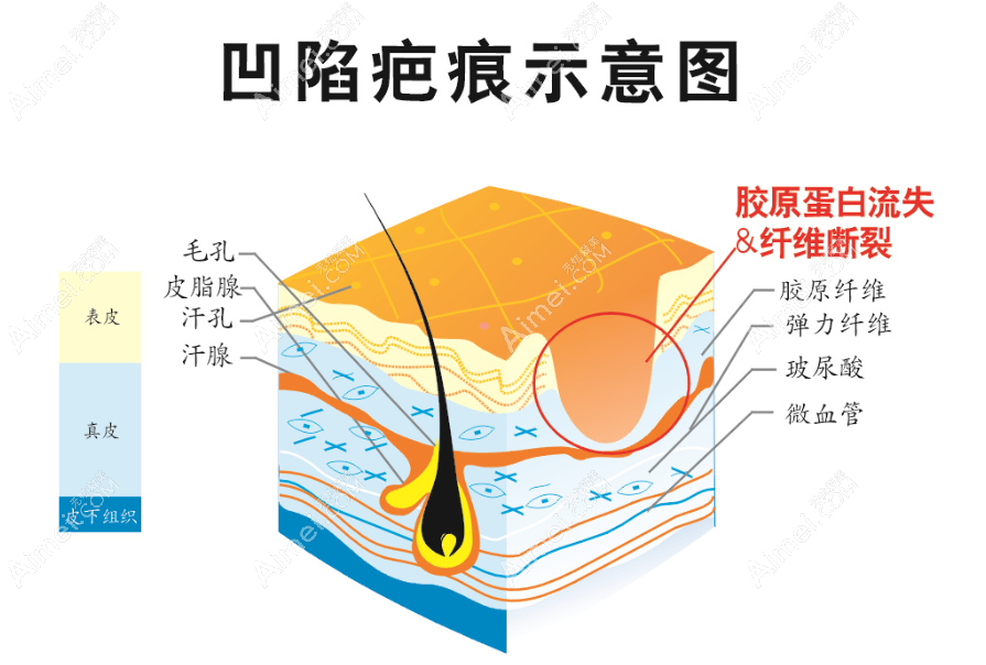 成都友谊医院疤痕科是成都出名的疤痕医院