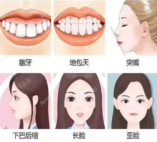 武汉中翰正颌改善脸型症状