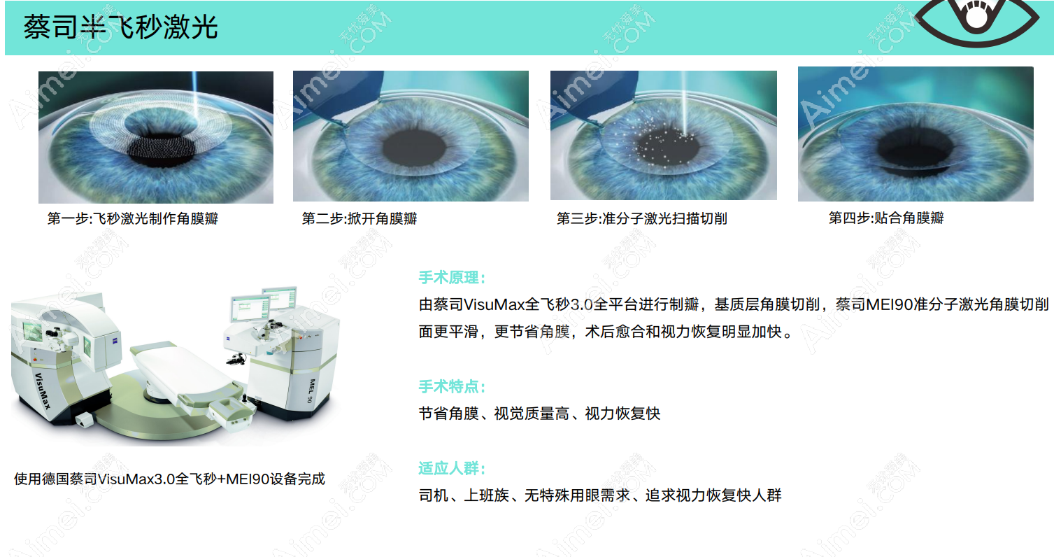 西安半飞秒近视术后价格9800元起