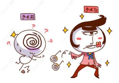 prk手术和全飞秒手术哪个好