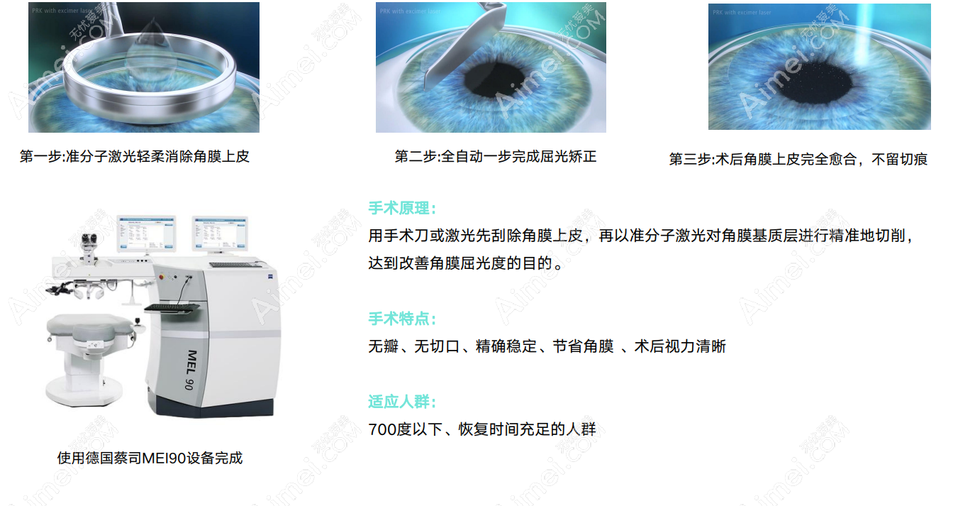 西安激光近视手术价格8800元起