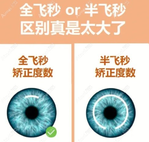 近视全飞秒和半飞秒手术的价格区别m.aim#ei.com