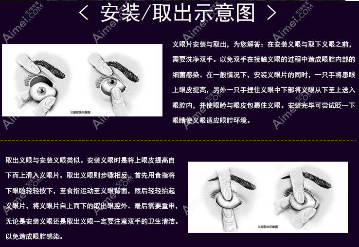 义眼的安装和佩戴