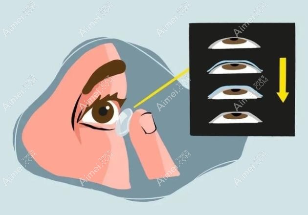 对比ok镜和rgp的区别