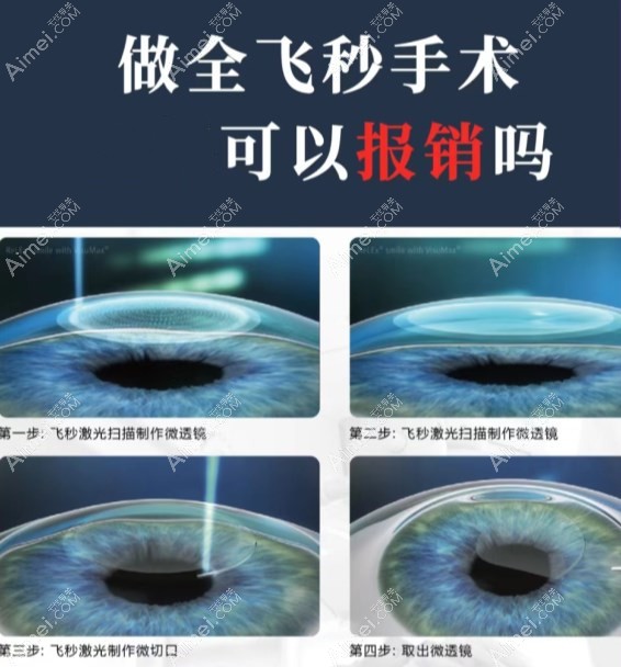 浅谈全飞秒近视手术能否报销,走农村合作医疗给报销多少呢