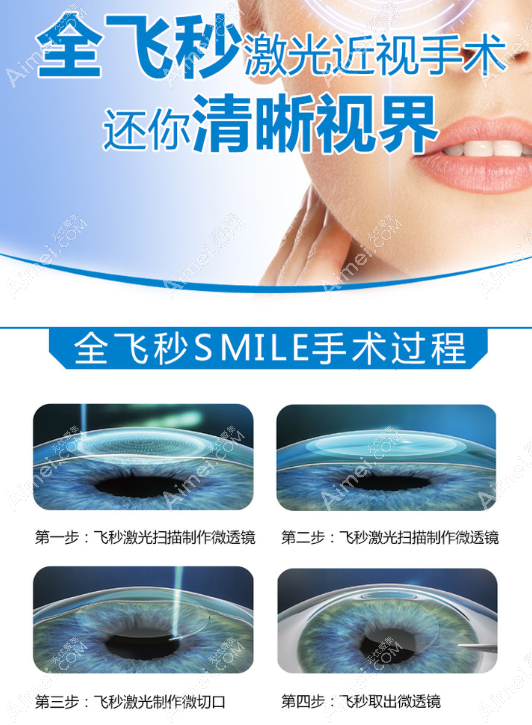 昆明全飞秒手术价格一览表