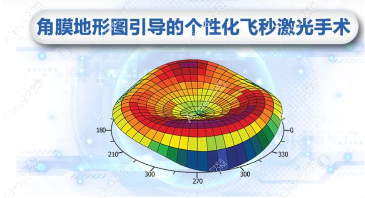 什么是个性化半飞秒手术