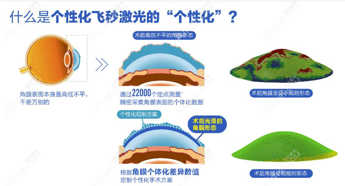 个性化半飞秒和普通半飞秒区别大