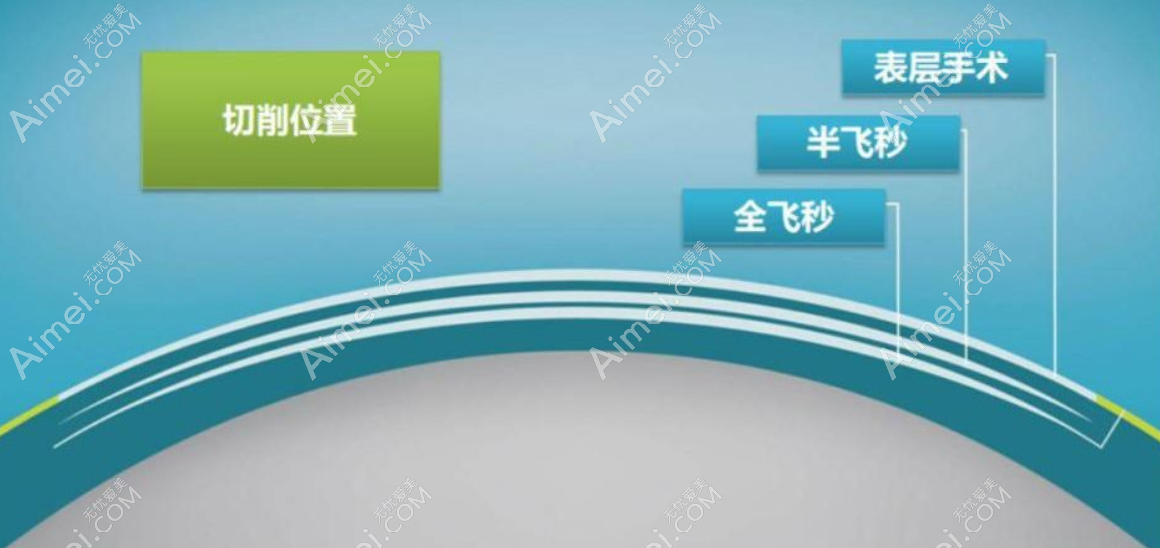 昆明眼科医院全飞秒和半飞秒激光切削位置区别