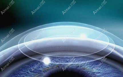 全飞秒手术价格20000元起 全飞秒手术价格20000元起