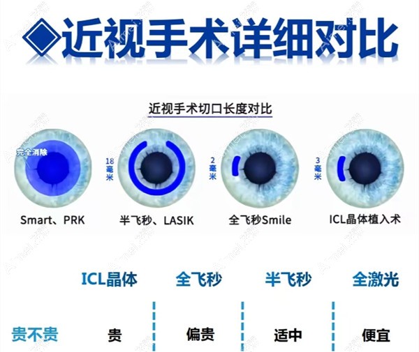 西安华厦眼科医院价格贵吗 西安华厦眼科医院价格贵吗