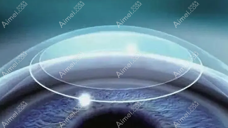 全飞秒比半飞秒伤害小 全飞秒比半飞秒伤害小