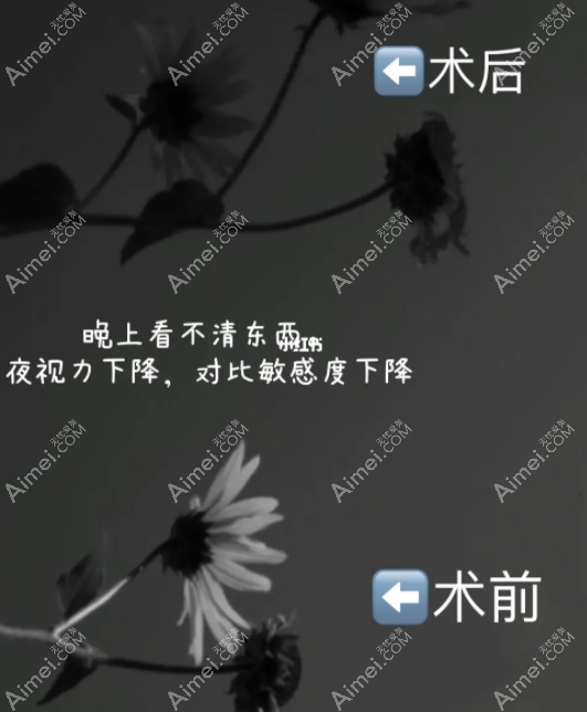 近视眼激光术后出现后遗症看东西模糊
