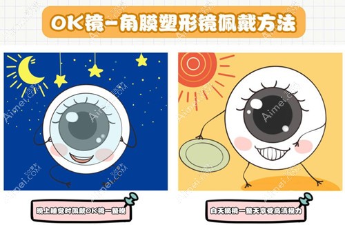 角膜塑形镜佩戴方式