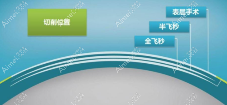 佰视佳眼科近视眼手术怎么样 佰视佳眼科近视眼手术怎么样