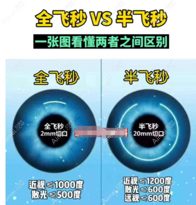 佰视佳眼科全飞秒手术价格 佰视佳眼科全飞秒手术价格