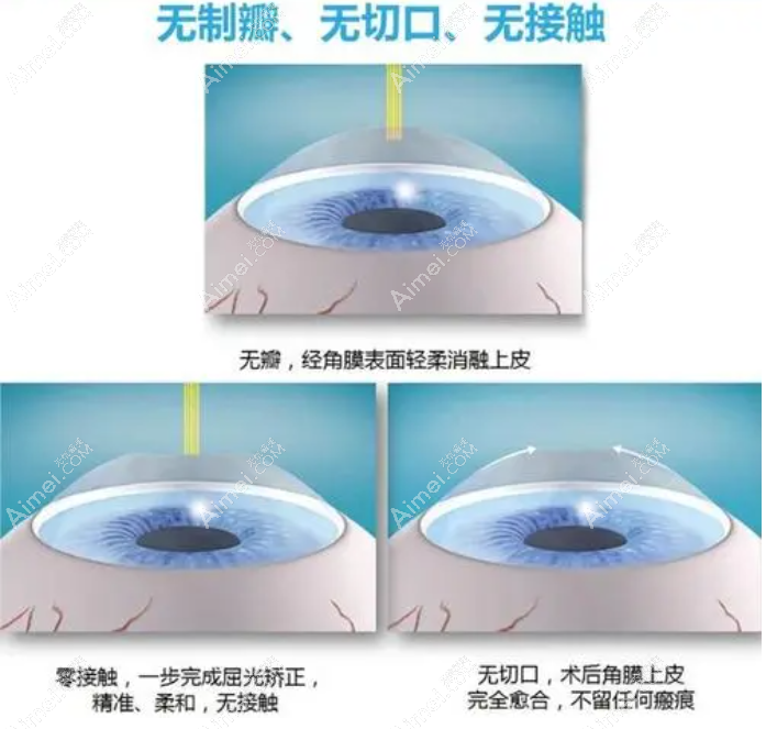 长沙全激光6800元起 长沙全激光6800元起