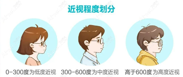 高度近视是指多少度 爱美网