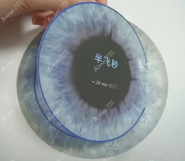 半飞秒手术切口图