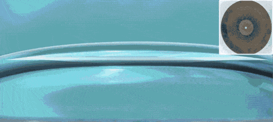 全飞秒手术过程